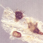 Soybean disease: Anthracnose - Acervuli